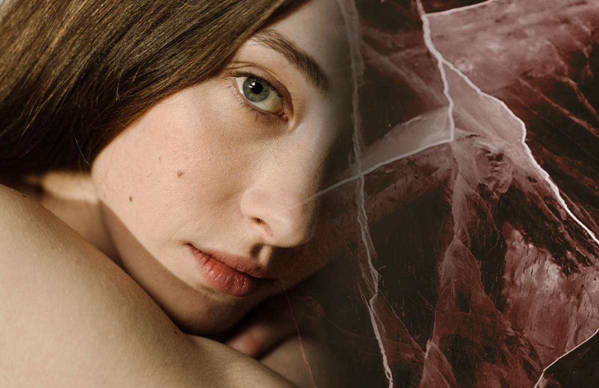 Anti-Scar ουλές αναπλαστική δράση τραύμα σημάδια